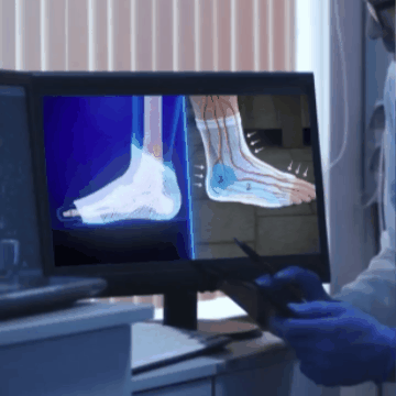 Calcetines de Alivio Rápido para Pies Hinchados y Adoloridos – Tecnología de Neuro-Compresión para un Descanso Instantáneo